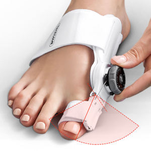 DEYU  Bunion Corrector High Quality Valgus Toe Corrector Hallux Valgus Orthotics Big Toe Corrector Foot Pain Relief  拇外翻矫正
