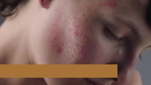 Glycolic Acid Resurfacing Pads (60 Count) 10% Ultra Pure Glycolic Acid + 2% Salicylic Acid Exfoliating Peel Pads for Face Effective Chemical Peel Radiant Skin Renewal