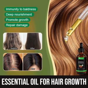 Batana Essential Oil For Hair Growth Fast Rapid Hair Growth Serum Anti Hair Loss Hair Care For Men & Women