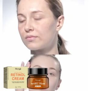 Krim Retinol Anti Penuaan: Solusi Perawatan Kulit Mengangkat Keriput