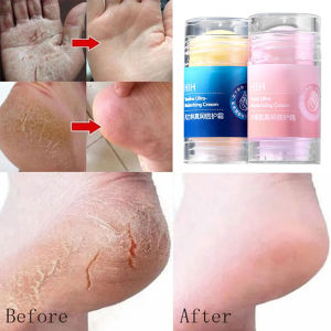 Vaseline Foot Moisturizing Cream Moisturizing Anti-Freeze Anti-Drying Foot Cream Hand Cracked Repair Cream Removal Dead Skin Hand Feet Care Skin