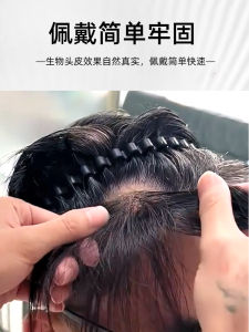 Invisible Scarless Hair Transplant Patch for Men And Women Real Hair Fake Hair Patch Hairline Sticker Natural Looking