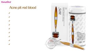 ZGTS 192 Needle Derma Roller Metal Microneedle Dermaroller Cho Mesotherapy Chăm Sóc Da Mặt Dụng Cụ Làm Đẹp Loại Bỏ Sẹo & Vết Rạn Da