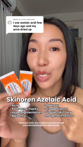 Skinoren Azelaic Acid 20% Cream Acne Removal And Pimples&Make Up Acne Treatment Melasma Cream.