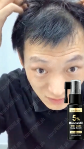 BUY1 TAKE1 KORMESIC Hair Care Set for Hair Regrowth and Scalp Health Anti-Hair Loss Korean Ginseng