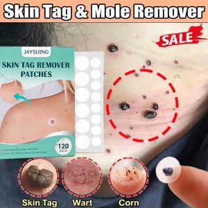 Wart Remover Patch 120pcs/box Safe Painless Skin Tags Patches Pimple Wart Treatment Patch Fast Acting Remover Warts Moles Natural Ingredients for All Skin
