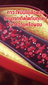 โคซานอล  กิฟ ฟารีน น้ำมันงาขี้ม่อน น้ำมันเมล็ดแฟลกซ์ วิตามินอี โอเมก้า 3 จากพืช ดูแลไขมัน ความดัน หลอดเลือด หัวใจ เลือดหนืด ตึงคอบ่าไหล่