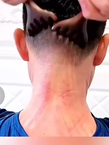 Lược 6 vuốt Kinh Tuyến Sừng Tendon Cạo Mặt Lược Massage giảm căng thẳng