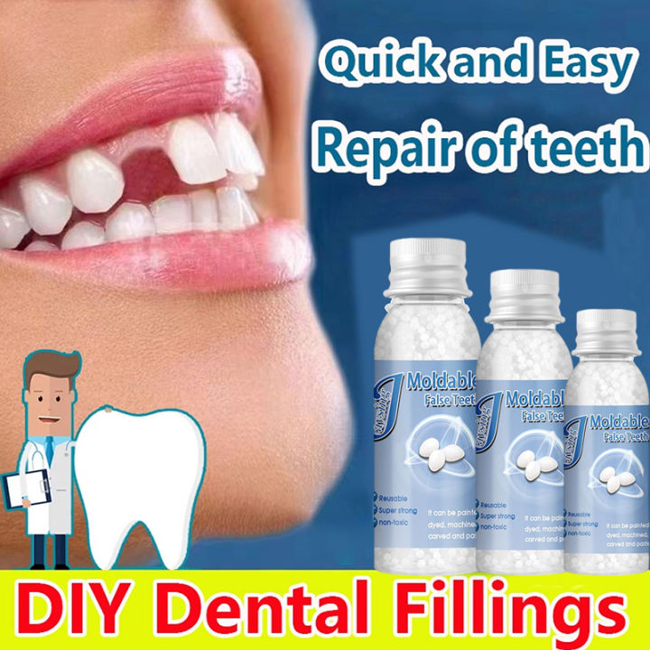 Temporary tooth repair teeth Set Solid Glue Tooth Filling Teeth And