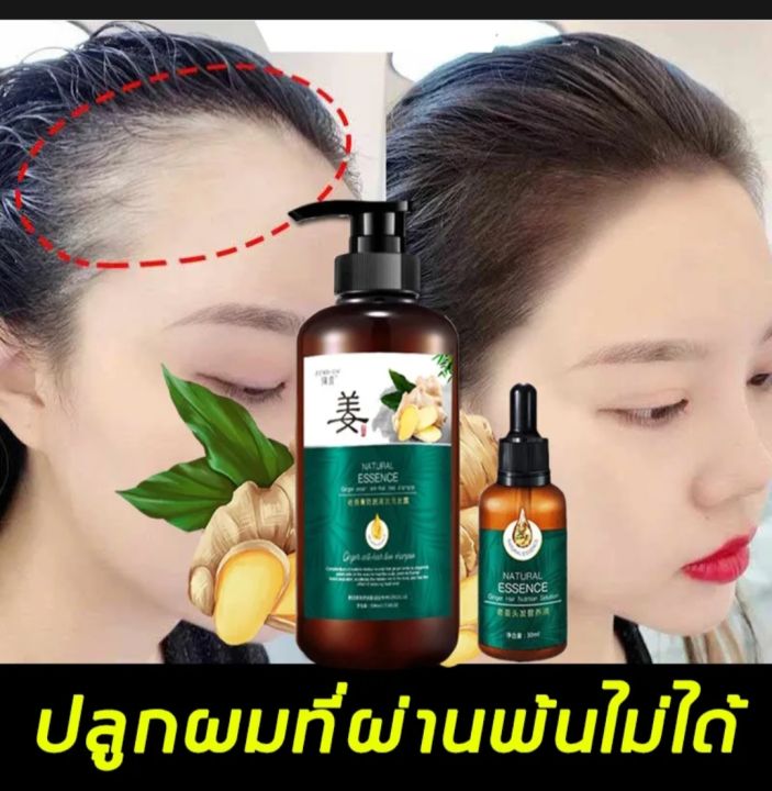 Zhenxiu ginger juice nourishing shampoo 2set Lazada.co.th