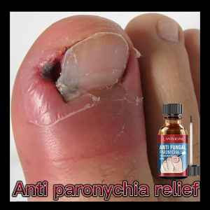 เล็บเชื้อรา เล็บที่เสียหาย 10มล.