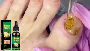 【BUY 2 TAKE 1】Jaysuing 7days Nail Quickly Repair Fungus Treatment Essence Nail Repair Care Removal Anti-Bacterial Onychomycosis Paronychia Anti-Fungal Nail Toe 30ml