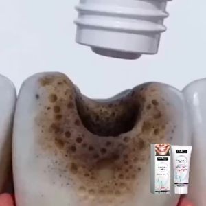 oralhoe | Anti Cavity Toothpaste Repair Tooth Decay Remove Dental Plaque Improve Bad Breath Prevent Carie Teeth Whiten Cleaning Toothpaste