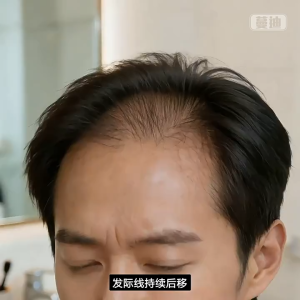 MANDI Hair Loss Serum Hair Tonic Hair Growth Serum Anti-Hair Loss Hair For Men Serum Rambut Gugur 90ML 生發水蔓迪生发液精华