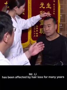 IULLURE Hair growth serum hair growth essence man‘s anti-hair loss hair growth serum alopecia areata elderly hair loss postpartum hair loss staying up late hair loss