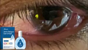 ximonth | Eye Drops for Dry Eyes Relief Fatigue Lubricant Eye Care Drops with Lutein & Vitamin E 15ml Portable Moisturizing Eye Solution