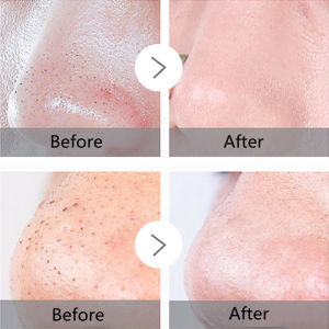 kale mud mask blackhead removal acne clay mask facial cleanser blackhead mask oily skin jerawat muka rough skin large pores 羽衣甘蓝泥膜100g