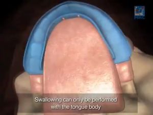 Oral Care Braces Tooth Correction Teeth Orthodontic Dental Alignment Trainer