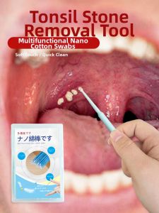 MINQI | Tonsil Stone Removal Tool Tonsil Stones Extractor for Hidden Crypts Odor Eliminator