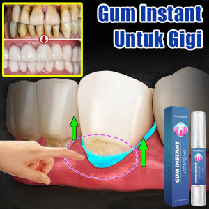 Penambal gigi Gusi bengkak Perawatan gigi berlubang Sakit gigi dan gusi gum instant untuk gigi gum care Gum Instant Untuk Gigi Penguat Gigi Goyang Obat Gusi Bengkak Gel Penambal Gigi Gum Care Gel Pemutih Gigi Kuning 10ml