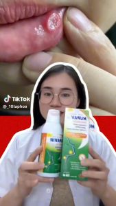 [Che tên] Nước súc miệng súc họng Hupavir 250ml hỗ trợ sùi hạt lympho cho cả nam và nữ