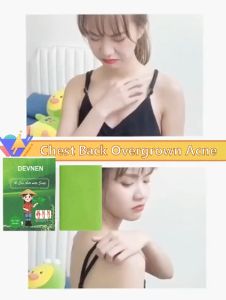 🔥 DEVNEN Sabun Gatal Kulit Wormwood Mite Removal Pemutih Badan Soap Herble Soap Eczema Treatment Anti Itching Anti Fungus Acne badan wajahJerawat Tungau Pembersih Dan Komedo 80g