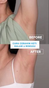 Brighty Underarm Scrub - Scrub Pencerah Ketiak