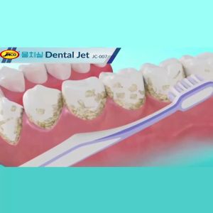 Jaco Dental Jet Semprotan Pembersih Gigi Dental Flosser Oral Irrigator Floss Water Flosser