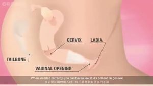 ถ้วยซับประจำเดือนช่อง ถ้วย Coppetta Mestruale Coupe Menstruelle สำหรับผู้หญิง