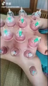 Vacuum Cupping Device Household Vacuum Pumping Set Cupping To Remove Moisture真空拔罐器