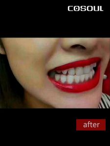 Electric Toothbrush Sonic Smart Toothbrush Teeth Brush Men Women Toothbrush