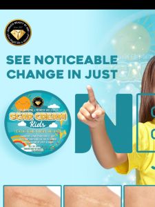 Effective Scar Remover for Kids - Peklat Remover sa Binti Kuda Mosquito Bites - Safe for Babies & Sensitive Skin - Old & New Scars Gel - Gentle & Non-Sticky - 10g