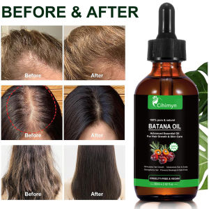 ⏰One Drop for Thicker Hair Growth🥇✨ Batana Oil Hair Growth Serum ✨ Thickening Elixir for Thinning Hair / 2X Thicker Hair / Biotin Organic DHT Blocker / Anti-Hair Loss Treatment 防脱增密精华