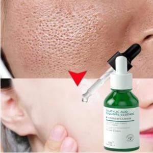Pore Minimizer Serum 30ML Shrink Pores Salicylic Moisturizing Whitening Oil Control Remove Blackhead Acne  Facial Care