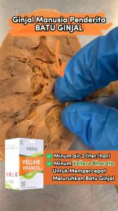 Vellare Bharata Original - Obat Batu Ginjal Batu Empedu - Kencing Batu Gagal Ginjal Paling Ampuh