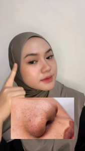 BREYLEE Masker Blackhead Langkah 1 & Langkah 2 - Serum Pori Treatment Abadi Mall