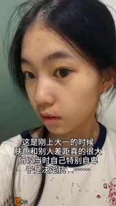 377 Whitening Essence 1.5ml*10pce Facial Serum Niacinamide Secondary Whitening Spot Essence Moisturizing Hydration And Wrinkles 377 Whitening Essence Original Solution 377次抛精华液