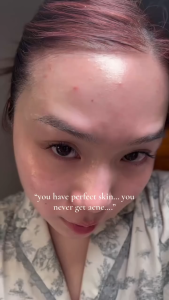 (VEMONTES OFFICIAL STORE) Axcne Booster Cream 25ml | 50ml - COCOMO