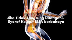 TERLARIS!!! Nervofit Spray Asli BPOM - Obat Saraf Kejepit Spray - Saraf Kejepit Ampuh - Saraf Terjepit dan Sakit Pinggang - Nefoorvit Spray Obat Saraf Kejepit - Minyak Urut Untuk Saraf Terjepit - Obat Syaraf Kejepit di Pinggang
