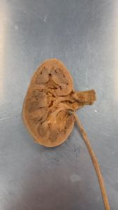 VELLARE BHARATA Obat Batu Ginjal Batu Empedu Herbal Alami Uji BPOM