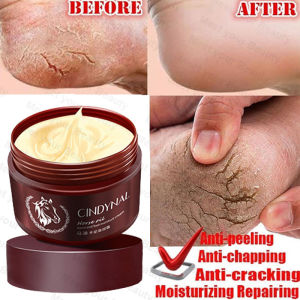 A.one Original horse oil Hand and Foot Salve Cream 110g anti-cracking cream Horse Oil Foot Cream Moisturizing for Rough Dry and Cracked Chapped Feet Heel Anti-Aging Horse Oil Dry Skin Care Moisturizing Whitening Horse Oil Callus Horse Oil Hand Foot Cream