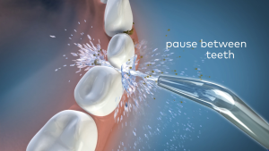 Waterpik Cordless Select Dual Pack Rechargeable Water Flosser 2x WF-10K with Dual Pressure Control & 5 Tips