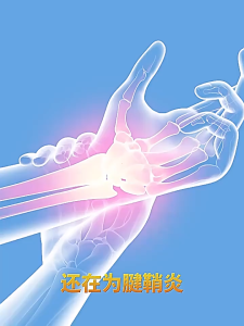 Sabuk Terapi Pergelangan Tangan Nyaman Wristband Olahraga untuk Mouse Pain & Cedera Decker