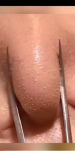 Yan Jiayi eggplant cleansing solid mud mask stick application mask green tea mud mask pore cleaning mud mask 40g blackheads closed acne shrink pores