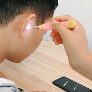 (HCM)Dụng Cụ Lấy Ráy Tai Có Đèn Đầu Mềm An Toàn Cho Bé - Lấy ráy tai có đèn 3 đầu