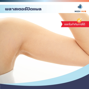 พลาสเตอร์ปิดแผล (จำนวน 1 กล่อง) KLEANPAD WOUND DRESSING อุปกรณ์ทำแผล
