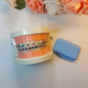 ขี้ผึ้งสำหรับคนจัดฟัน  (เลือกกลิ่นได้) แก้ปัญหาระคายเคืองช่องปาก เลือกกลิ่นได้ พร้อมส่ง 1ตลับมี5แท่ง