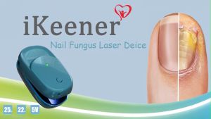 IKeener Nail Fungus Laser 905Nm Phototherapy Paronychia Foot Paronychia Foot Care Home Phototherapy Paronychia Mini Toenail Onychomycosis Therapy Led Cure