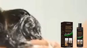 Anti-Dandruff Shampoo For Hair Growth Formula Anti-Hair Fall Nourishing and Scalp Soothing Natural Ingredients 头皮清洁洗发水