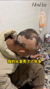 【Lazada Choice🔥】NewHair Hair Growth Tonic 全马唯一 发量暴涨 | Kuatkan Folikel Rambut | Anti Gugur & Tumbuh Rambut Baru 100ML